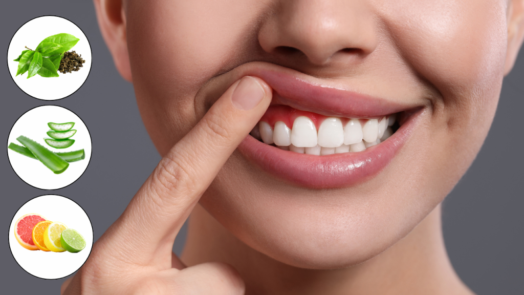 Natural Remedies for Preventing and Treating Gum Disease