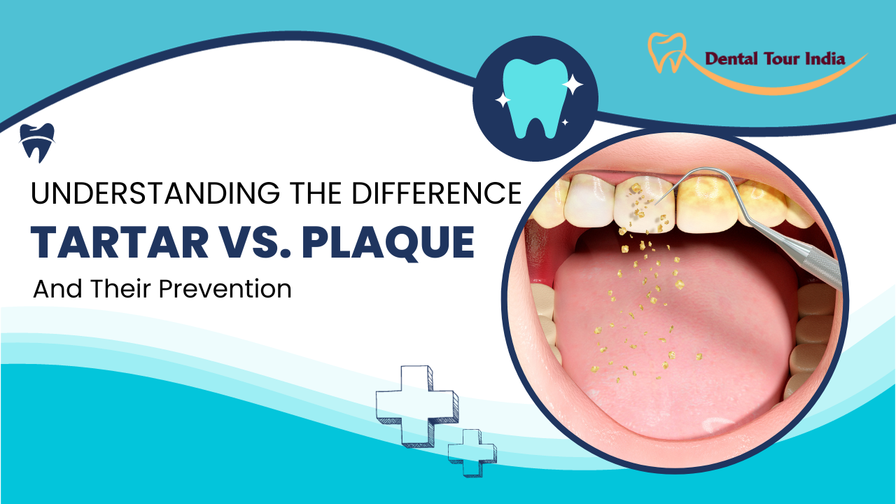 Tartar vs. Plaque: Understanding the Difference and How to Prevent Both