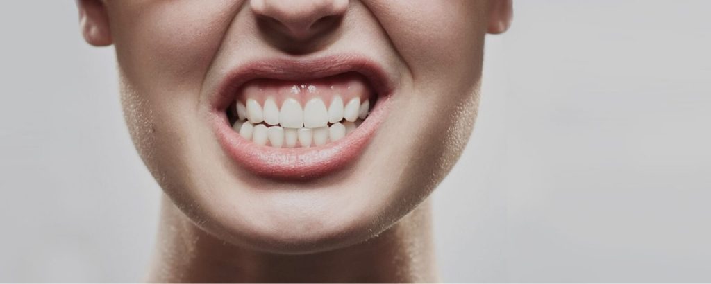 Address Bruxism