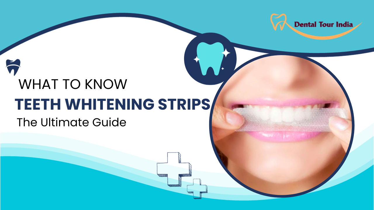 Teeth Whitening Strips, What to know, The ultimate guide