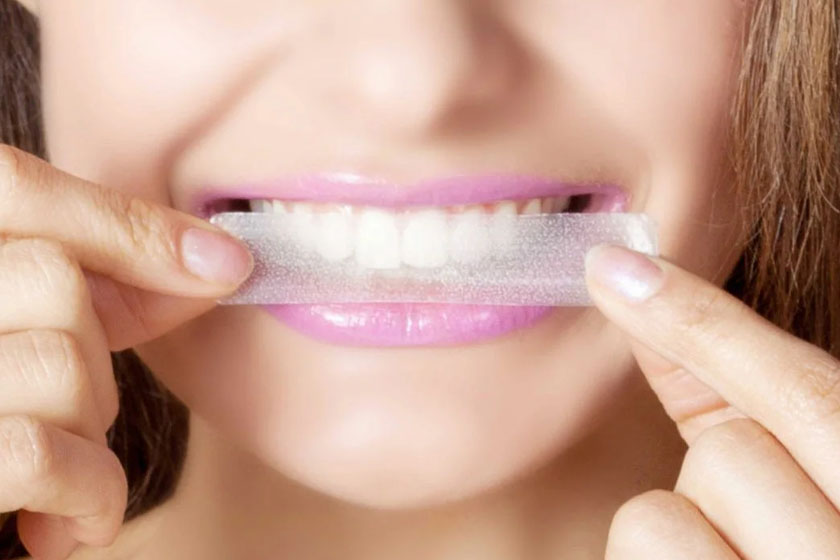 Teeth Whitening Strips