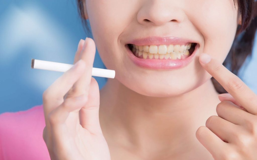 Smoking and Its Impact on Dental Implants