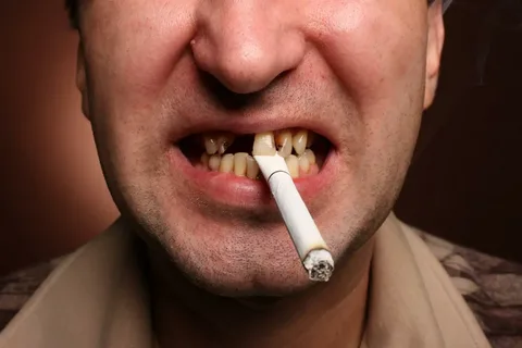 The Impact of Smoking and Tobacco Use on Gum Health